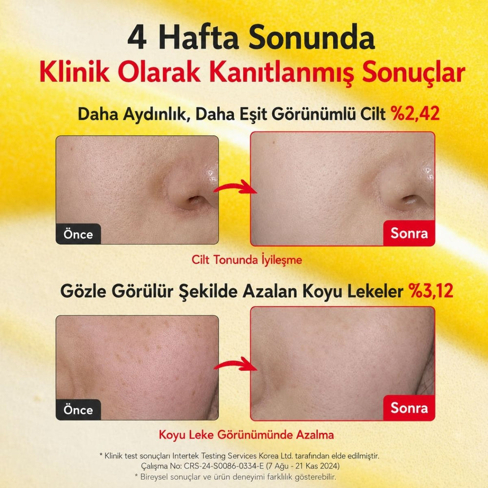 Eqqualberry Vitamin Illuminating Serum - Leke Önleyici C Vitamini Serumu 30ml