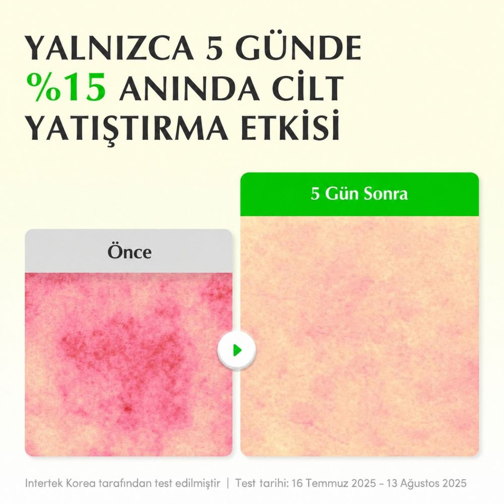 EQQUALBERRY Aloe PDRN Serum - Yatıştırıcı Bakım Serumu 30ml