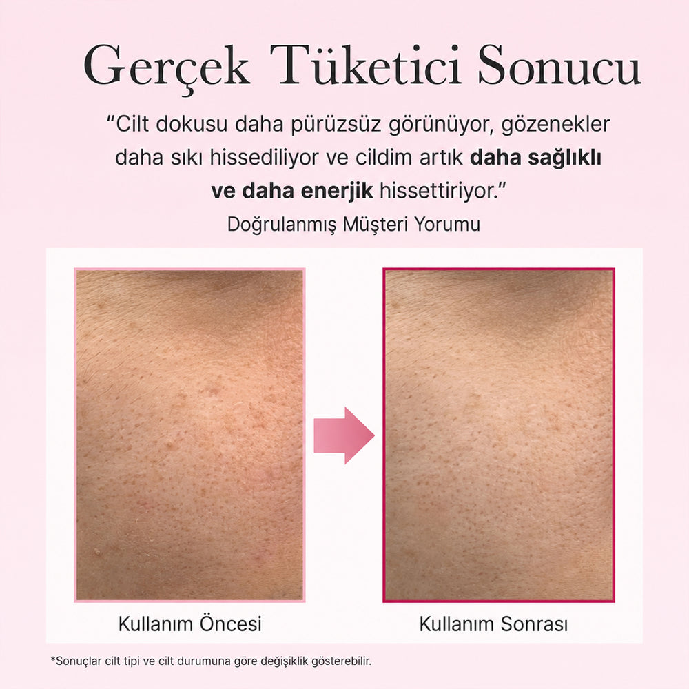 Arencia PDRN Booster Shot - Yenileyici Serum 30ml