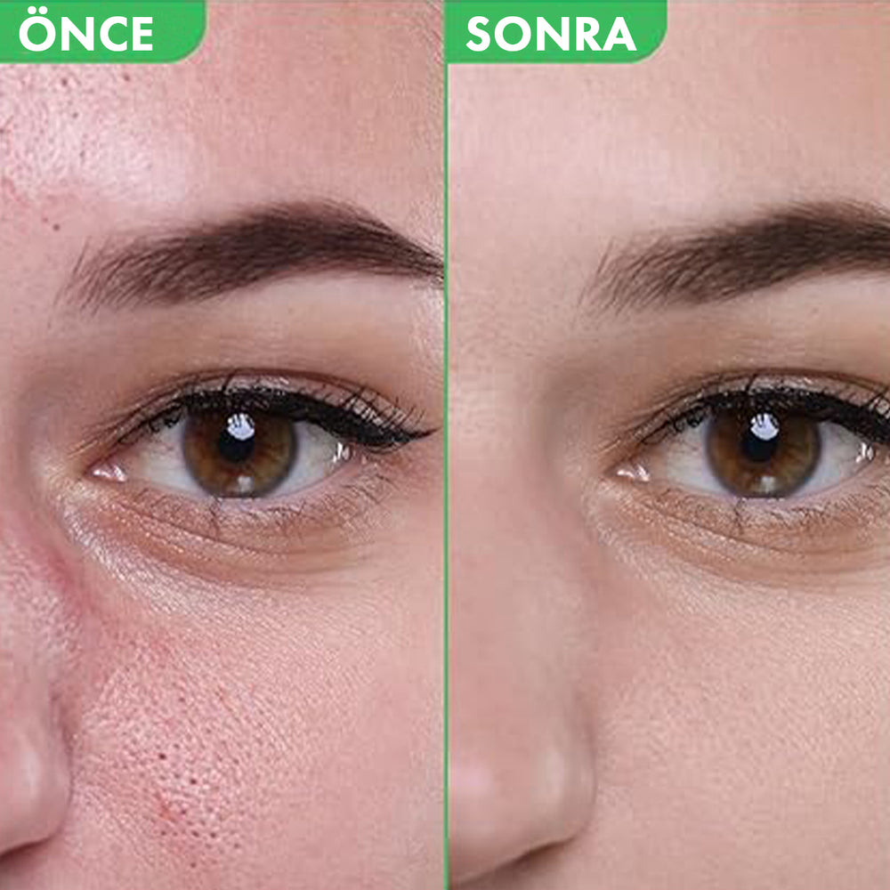 Fully Green Tomato Toner - Gözenek Sıkılaştırıcı 250ml