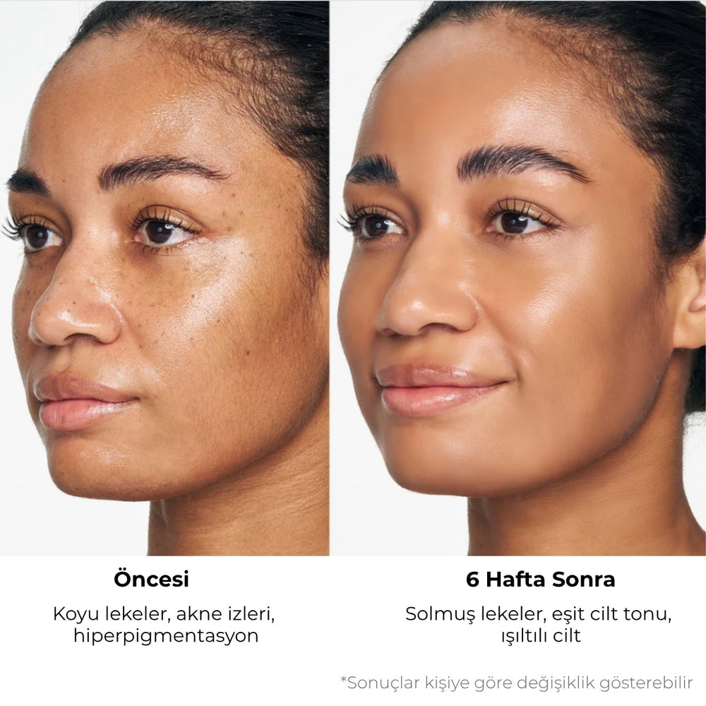Sungboon Kojic Acid Niacinamide Cleanser - Temizleyici 120gr