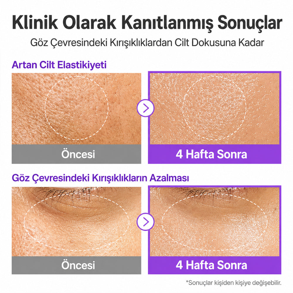 Numbuzin No.9 NAD Bio Lifting-Sil Essence - Sıkılaştırıcı 50ml