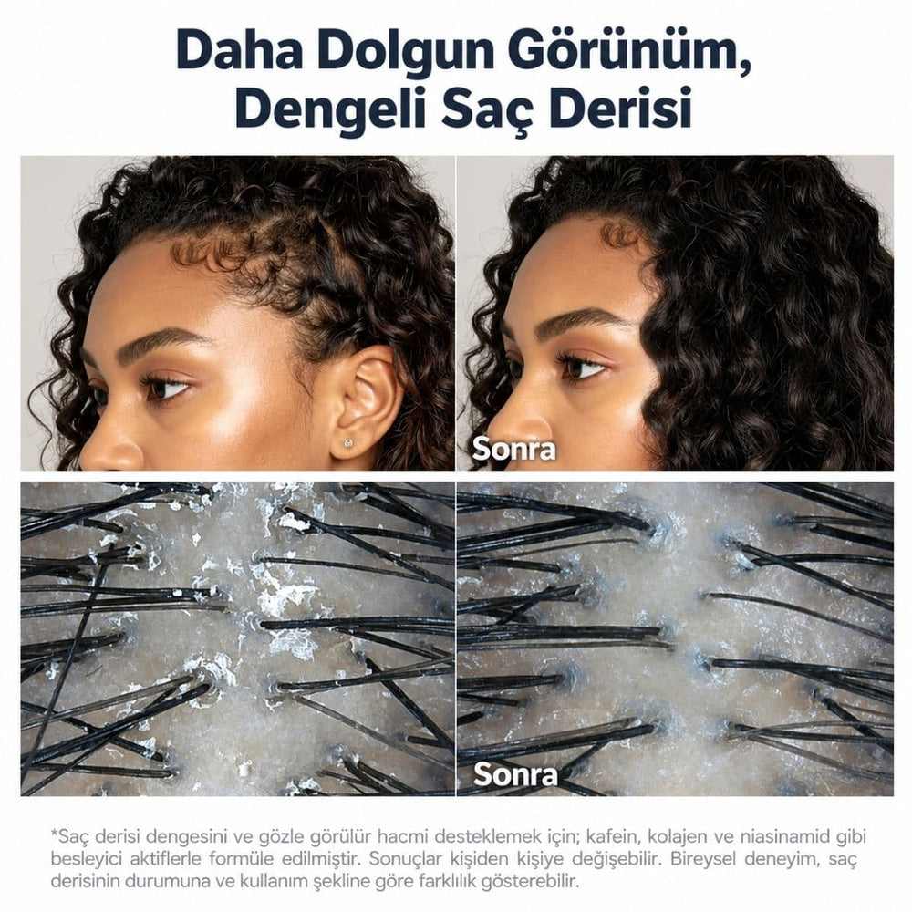 Sungboon Deep Collagen Retinol Power Boosting Scalp Serum - Saç Güçlendirici 15ml