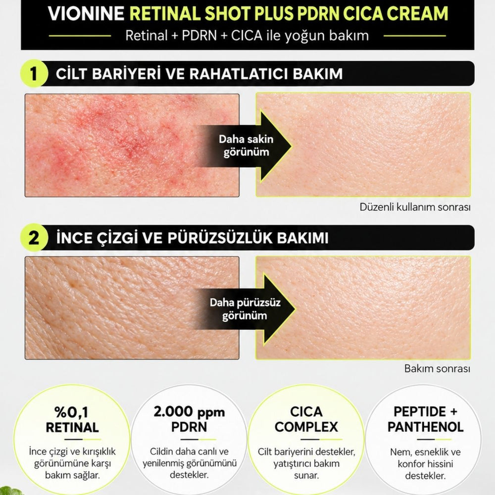 Vionine Retinal Shot Plus PDRN Cica Cream 2’li Set - %0,1 Retinal İçeren PDRN Cica Krem Seti 20 ml x 2