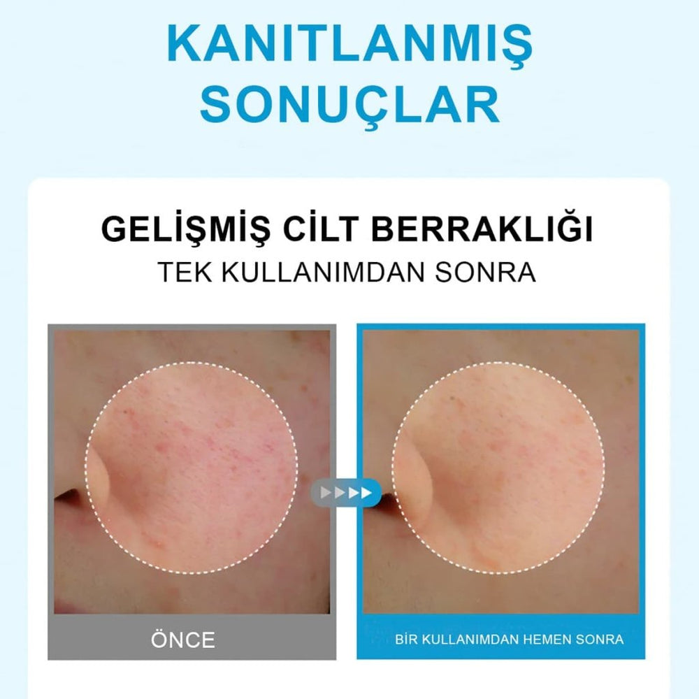 Centellian24 Hyal Waterfull Glow Gel Mask / Hyaluronik Asit İçeren Soğutucu Hidrojel Maske (22mlx5 Adet) - Centellian24 - Vionine