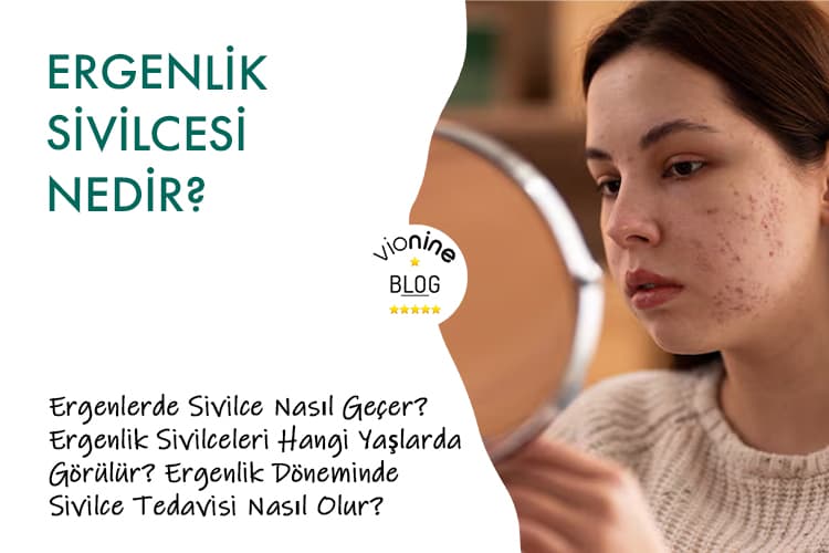 Ergenlik Sivilcesi Nedir?