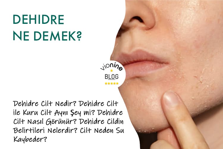 Dehidre Ne Demek?
