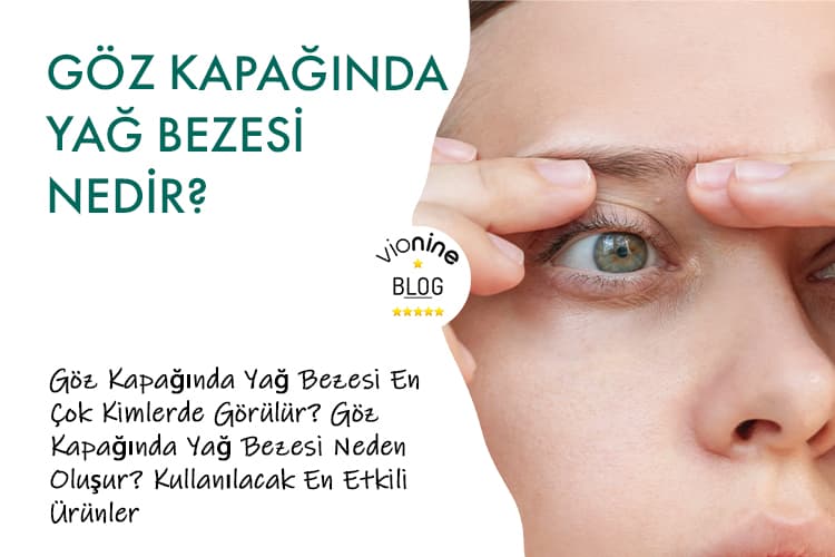 Göz Kapağında Yağ Bezesi Nedir?