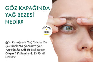 Göz Kapağında Yağ Bezesi Nedir?