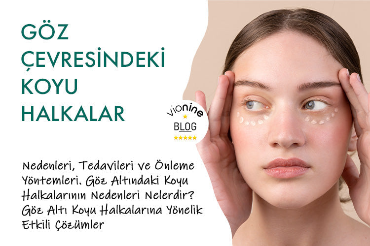 Göz Çevresindeki Koyu Halkalar