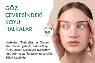 Göz Çevresindeki Koyu Halkalar