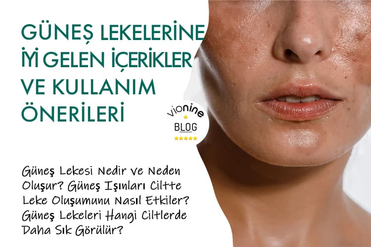 Güneş Lekelerine İyi Gelen İçerikler ve Kullanım Önerileri