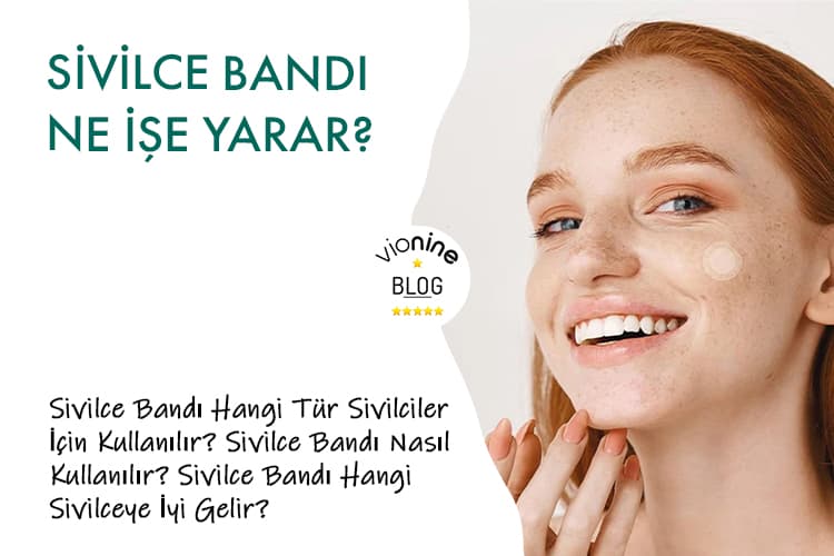 Sivilce Bandı Ne İşe Yarar?