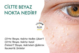 Ciltte Beyaz Nokta Nedir?