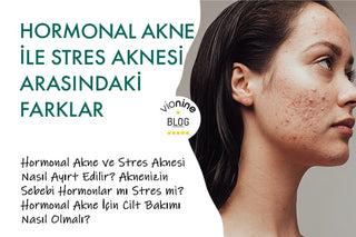 Hormonal Akne ile Stres Aknesi Arasındaki Farklar