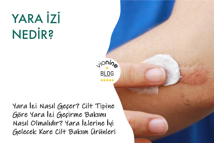 Yara İzi Nedir?