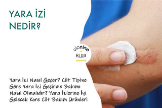 Yara İzi Nedir?