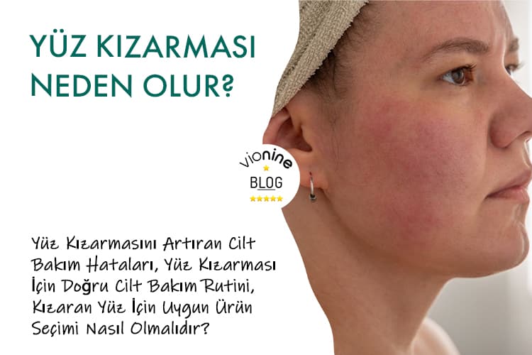 Yüz Kızarması Neden Olur?