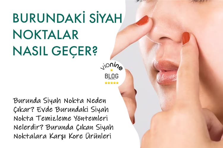 Burundaki Siyah Noktalar Nasıl Geçer? - Vionine