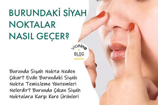 Burundaki Siyah Noktalar Nasıl Geçer?