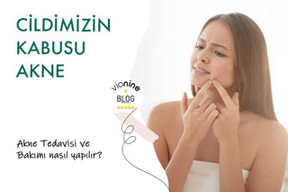 Akne Nedir, Neden Olur? Bakım Rehberi