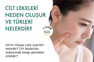 Cilt Lekeleri Neden Oluşur ve Türleri Nelerdir?