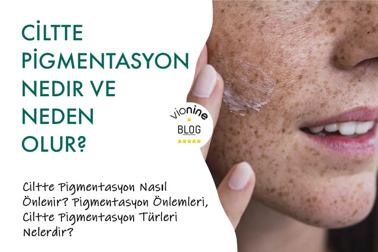 Ciltte Pigmentasyon Nedir ve Neden Olur? - Vionine