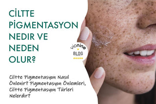 Ciltte Pigmentasyon Nedir ve Neden Olur?