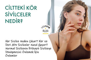 Ciltteki Kör Sivilceler Nedir?