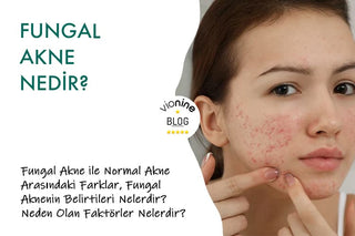 Fungal Akne Nedir?