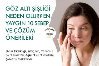 Göz Altı Şişliği Neden Olur?