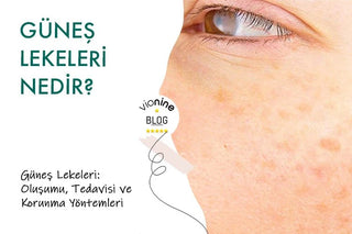 Güneş Lekeleri Oluşumu Tedavisi ve Korunma Yöntemleri