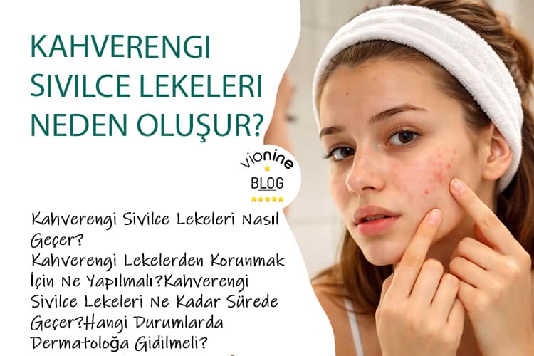 Kahverengi Sivilce Lekeleri Neden Oluşur?