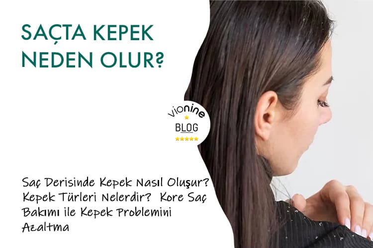 Saçta Kepek Neden Olur? - Vionine