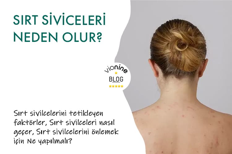 Sırt Sivilceleri Neden Olur? - Vionine