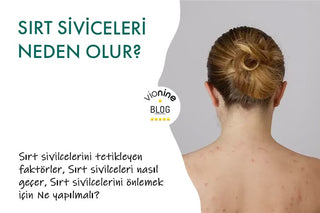 Sırt Sivilceleri Neden Olur?