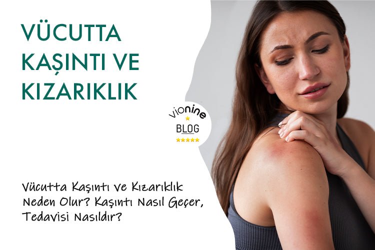 Vücutta Kaşıntı ve Kızarıklık Neden Olur? - Vionine