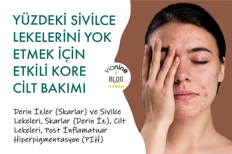 Yüzdeki Sivilce Lekelerini Yok Etmek İçin Etkili Kore Cilt Bakımı - Vionine