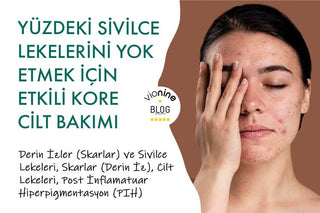 Yüzdeki Sivilce Lekelerini Yok Etmek İçin Etkili Kore Cilt Bakımı