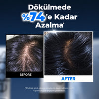 Epais Scalp Boosting Ampoule 150ml