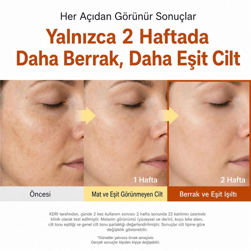 Sungboon Kojic Acid Niacinamide Ampoule - Leke Karşıtı 40ml
