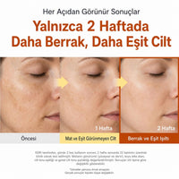 Sungboon Kojic Acid Niacinamide Ampoule - Leke Karşıtı 40ml