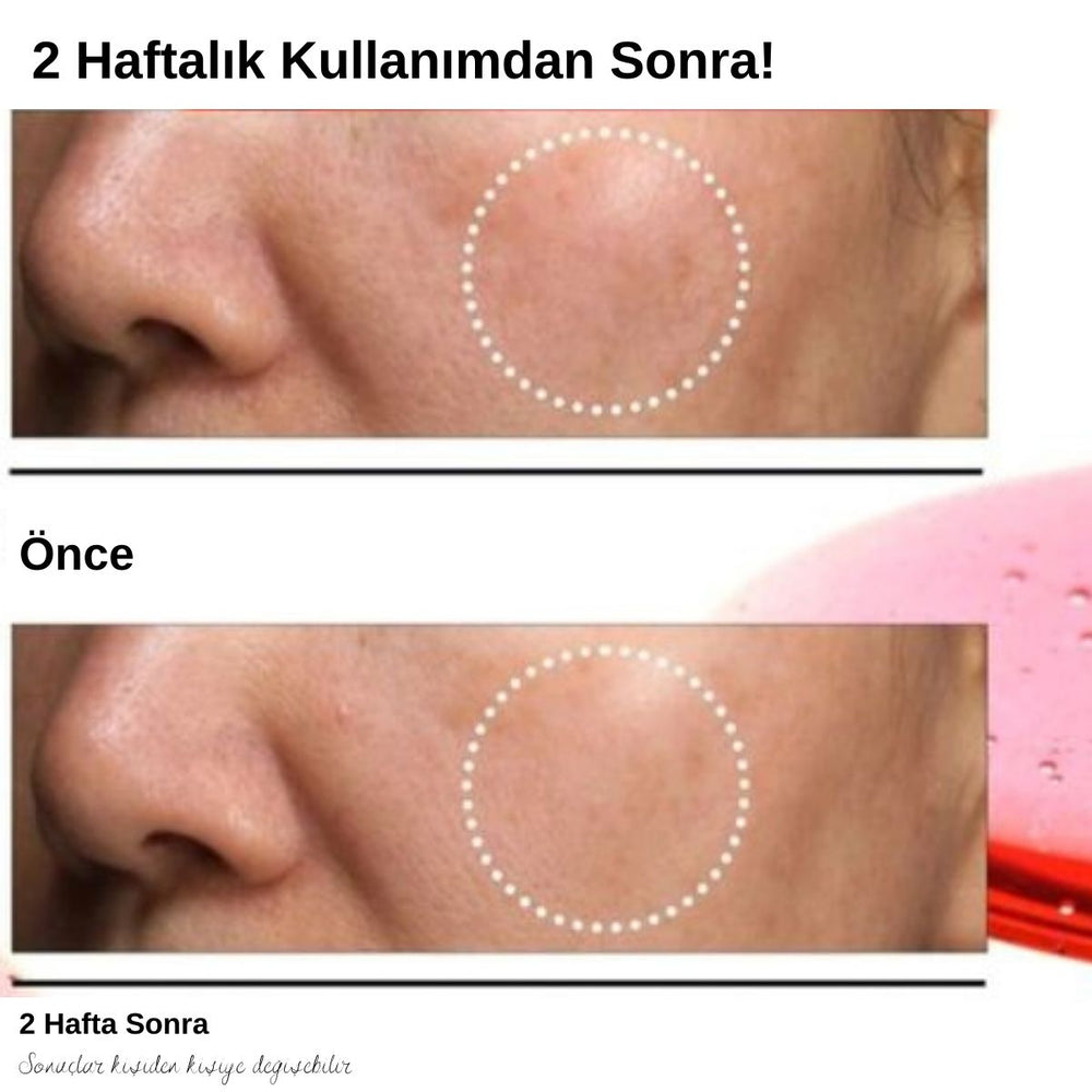 Anua Niacinamide 10% + TXA 4% Serum - Ton Eşitleyici 30ml
