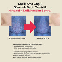 Anua Heartleaf Pore Control - Yüz Temizleme Yağı 200ml