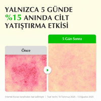 EQQUALBERRY Aloe PDRN Serum - Yatıştırıcı Bakım Serumu 30ml