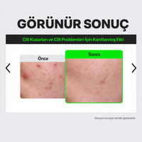 FATION Rapid Calming Barrier Cream - Yatıştırıcı Bariyer Kremi 45ml