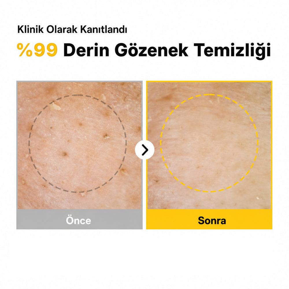 Ma:nyo Pure Soybean Cleansing Oil - Temizleme Yağı 200ml