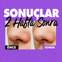 FATION Nosca9 Cleansing Foam - Temizleme Köpüğü 150ml