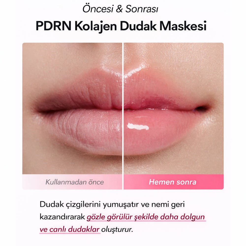 Abib PDRN Collagen Lip Mask - Dudak Maskesi 10ml