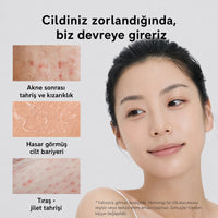 Arencia Eraser Soothing Cream - Yatıştırıcı 50ml